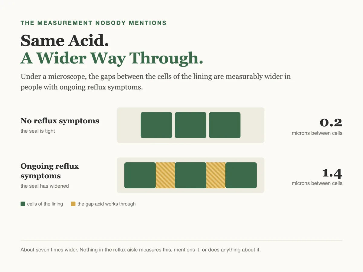 Chart comparing the gaps in the lining, about 0.2 microns without reflux symptoms and about 1.4 microns with them