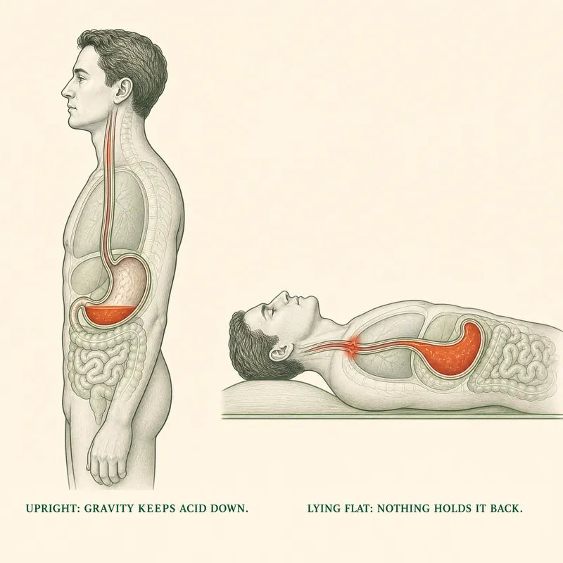 Diagram comparing standing upright, where gravity keeps stomach acid down, with lying flat, where acid rests against the esophagus